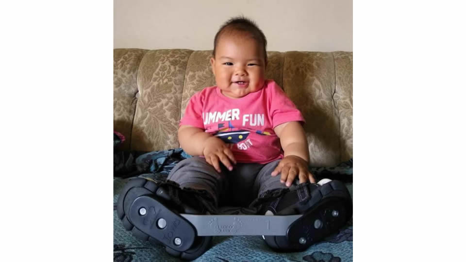 Proyecto Cambiando Vidas - Banco de férulas